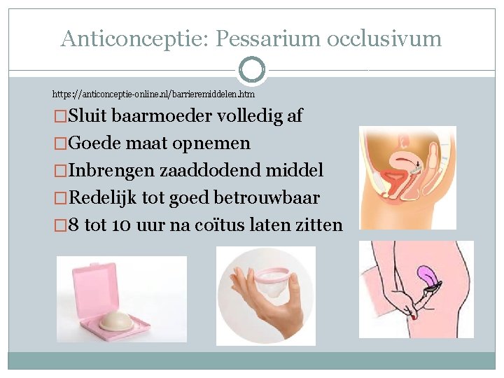 Anticonceptie: Pessarium occlusivum https: //anticonceptie-online. nl/barrieremiddelen. htm �Sluit baarmoeder volledig af �Goede maat opnemen