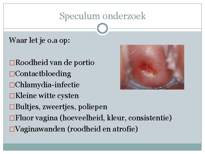 Speculum onderzoek Waar let je o. a op: �Roodheid van de portio �Contactbloeding �Chlamydia-infectie