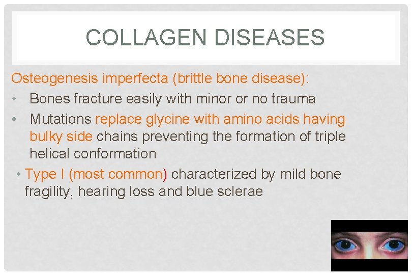 COLLAGEN DISEASES Osteogenesis imperfecta (brittle bone disease): • Bones fracture easily with minor or