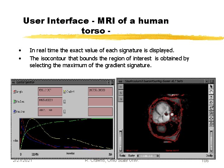 User Interface - MRI of a human torso • • In real time the