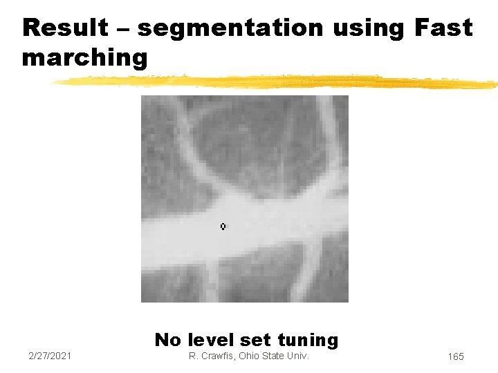 Result – segmentation using Fast marching 2/27/2021 No level set tuning R. Crawfis, Ohio