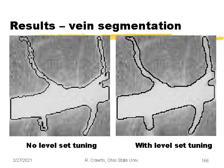 Results – vein segmentation No level set tuning 2/27/2021 With level set tuning R.