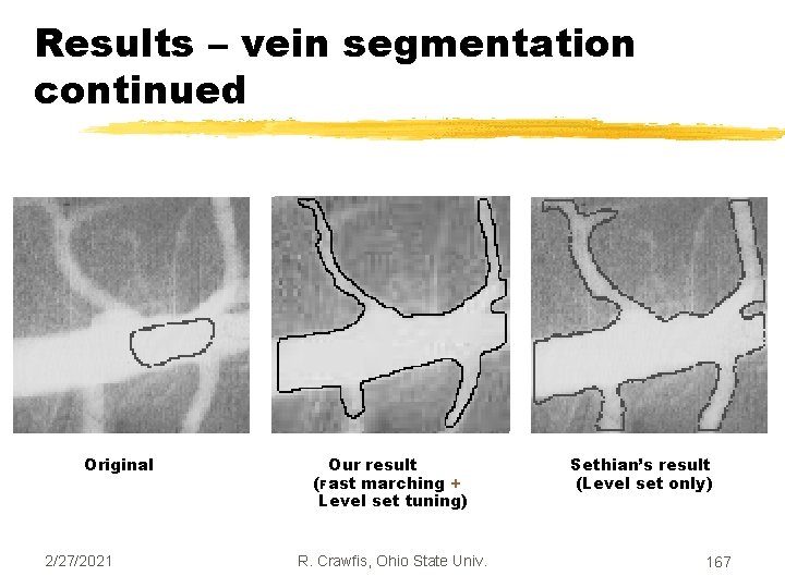 Results – vein segmentation continued Original 2/27/2021 Our result (Fast marching + Level set