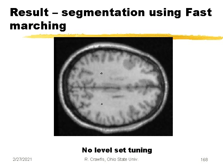 Result – segmentation using Fast marching No level set tuning 2/27/2021 R. Crawfis, Ohio