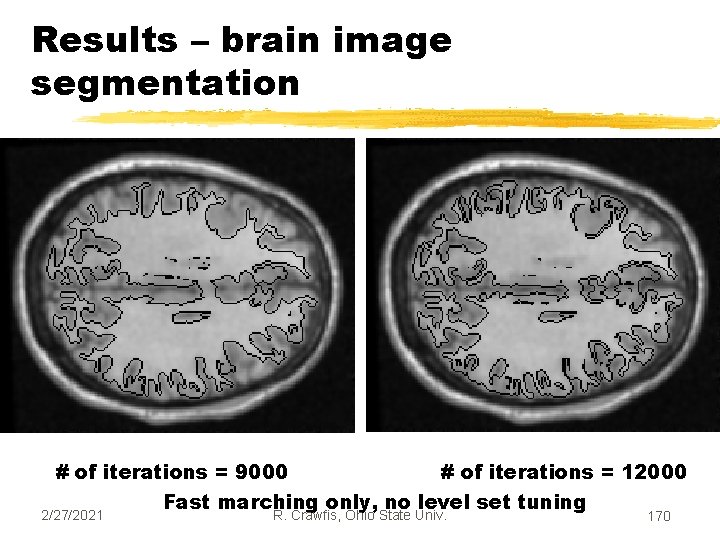 Results – brain image segmentation # of iterations = 9000 # of iterations =