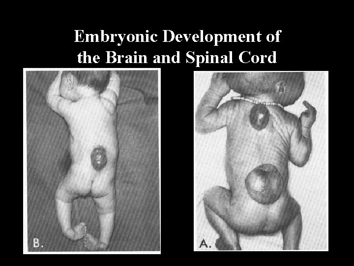 Embryonic Development of the Brain and Spinal Cord 