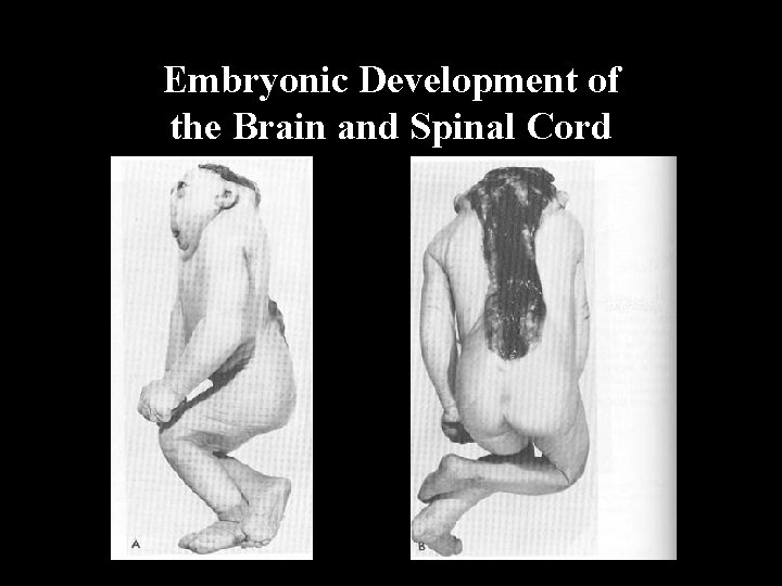 Embryonic Development of the Brain and Spinal Cord 
