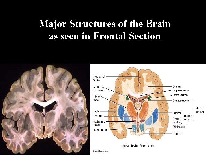 Major Structures of the Brain as seen in Frontal Section 