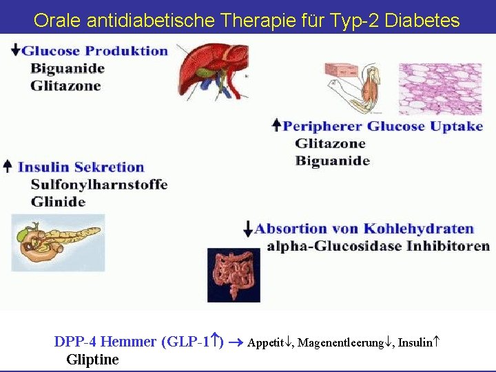 Orale antidiabetische Therapie für Typ-2 Diabetes DPP-4 Hemmer (GLP-1 ) Appetit , Magenentleerung ,