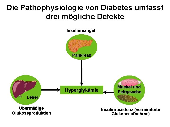 Die Pathophysiologie von Diabetes umfasst drei mögliche Defekte Insulinmangel Pankreas Hyperglykämie Muskel und Fettgewebe