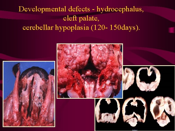 Developmental defects - hydrocephalus, cleft palate, cerebellar hypoplasia (120 - 150 days). 