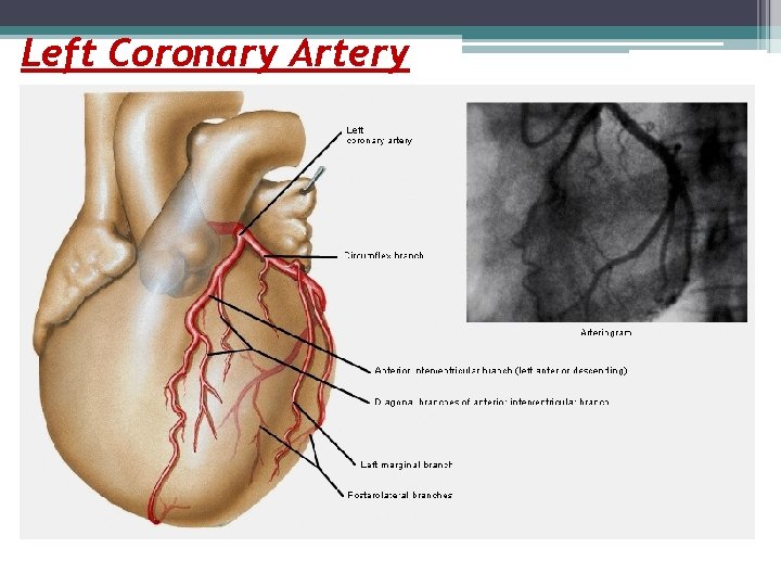 Left Coronary Artery 