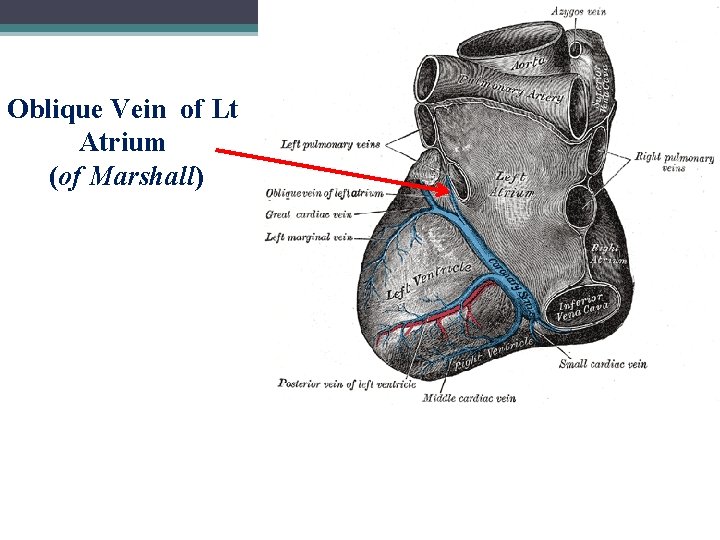 34 Oblique Vein of Lt Atrium (of Marshall) 
