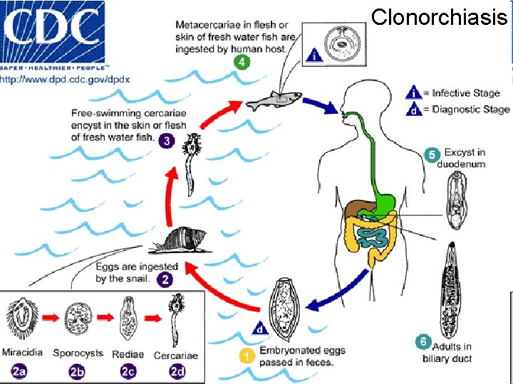 Clonorchiasis 