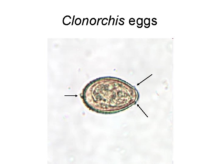 Clonorchis eggs 