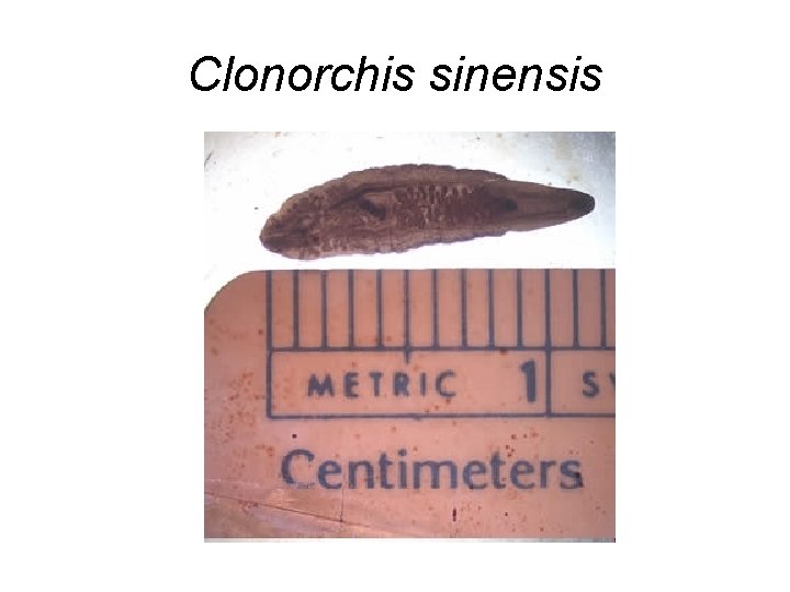 Clonorchis sinensis 