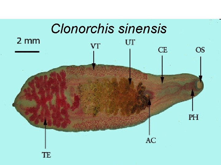 Clonorchis sinensis 