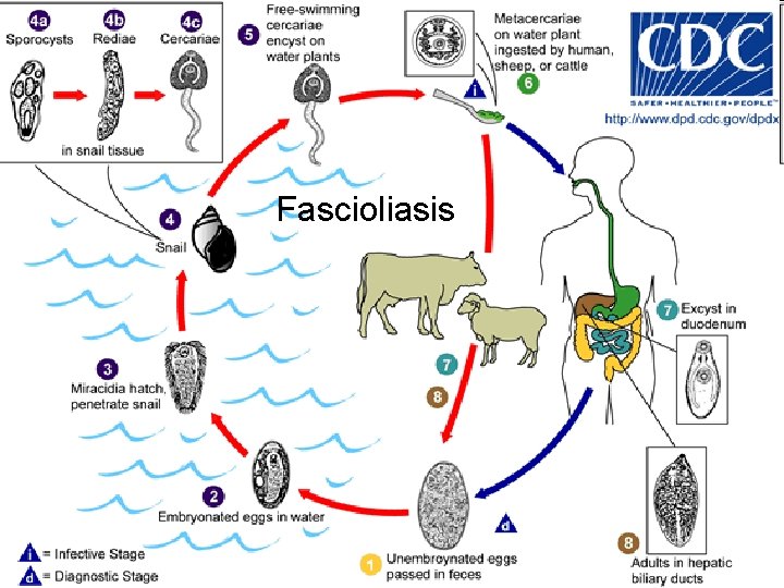 Fascioliasis 