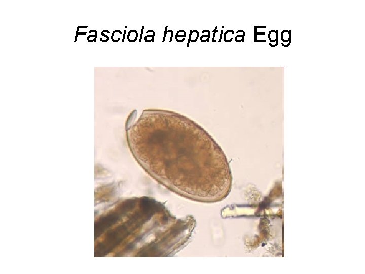 Fasciola hepatica Egg 