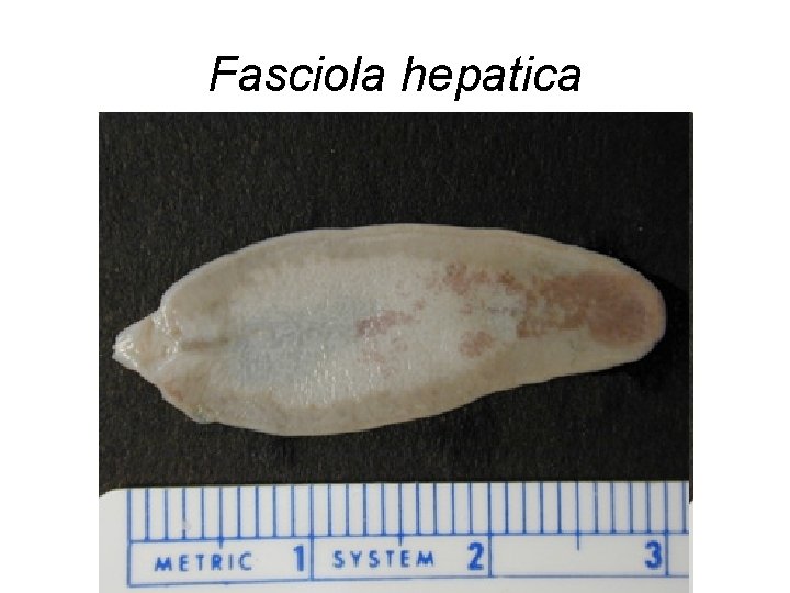 Fasciola hepatica 