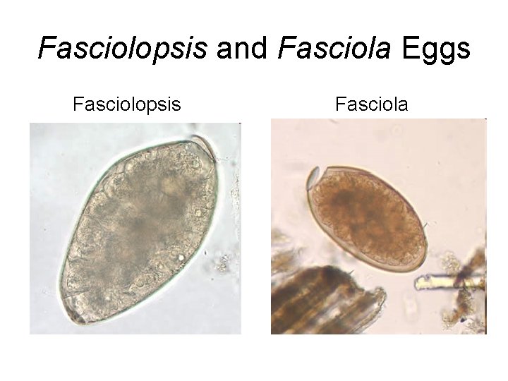 Fasciolopsis and Fasciola Eggs Fasciolopsis Fasciola 