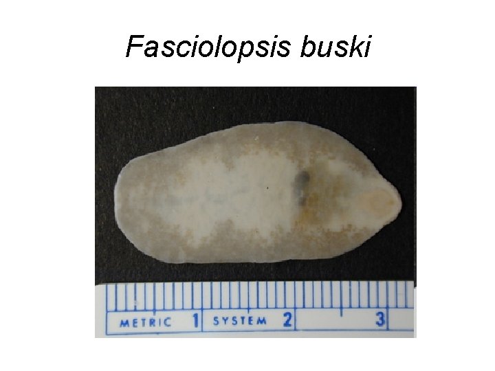 Fasciolopsis buski 