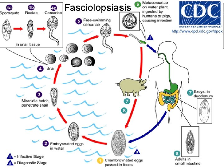 Fasciolopsiasis 