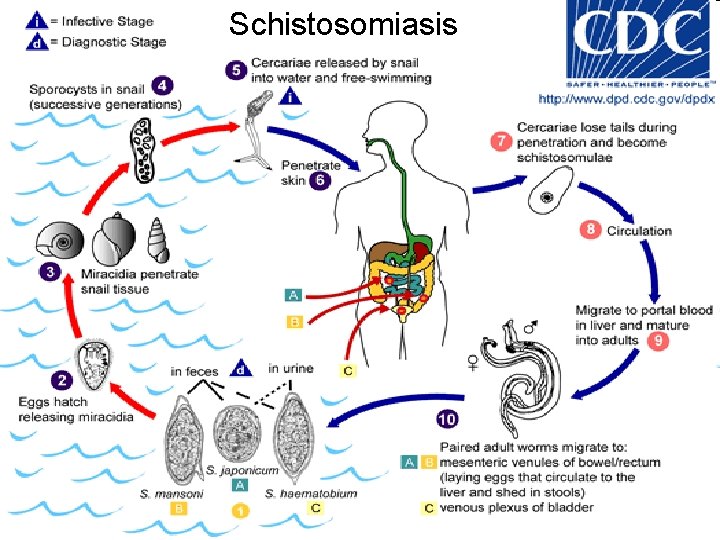Schistosomiasis 