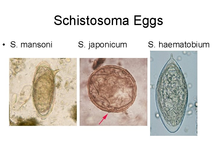 Schistosoma Eggs • S. mansoni S. japonicum S. haematobium 