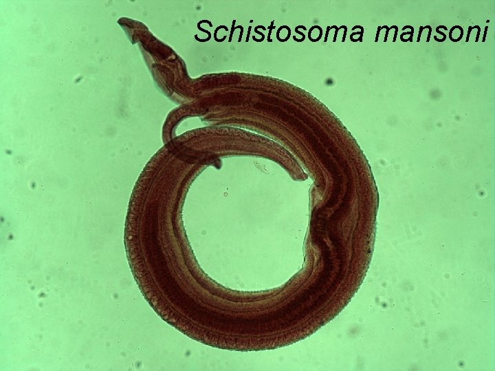 Schistosoma mansoni 