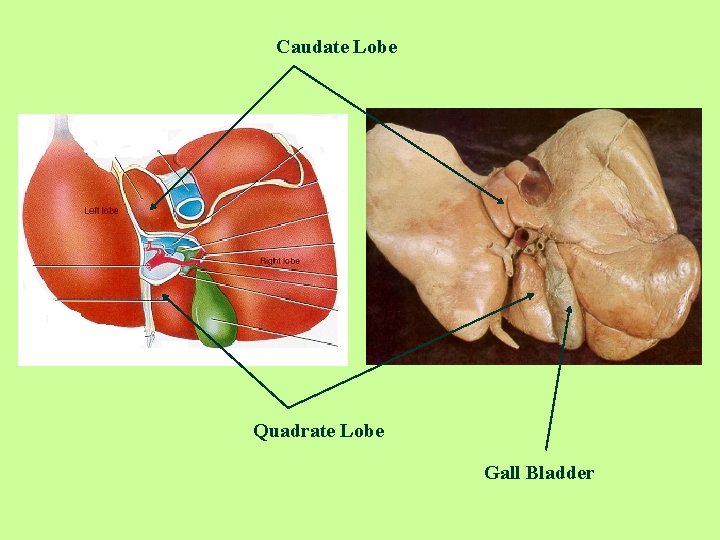 Caudate Lobe Quadrate Lobe Gall Bladder 
