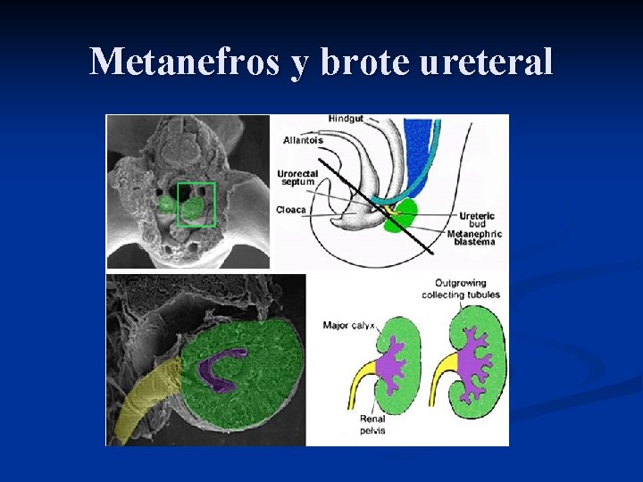 Metanefros y brote ureteral 