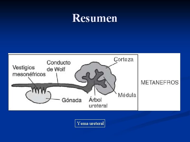 Resumen Yema ureteral 