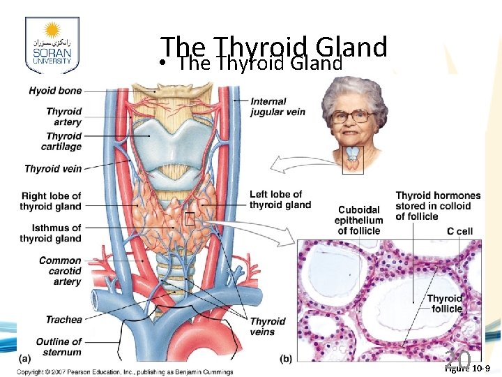 The Thyroid Gland • The Thyroid Gland www. soran. edu. iq 20 Figure 10