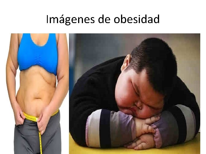 Imágenes de obesidad 