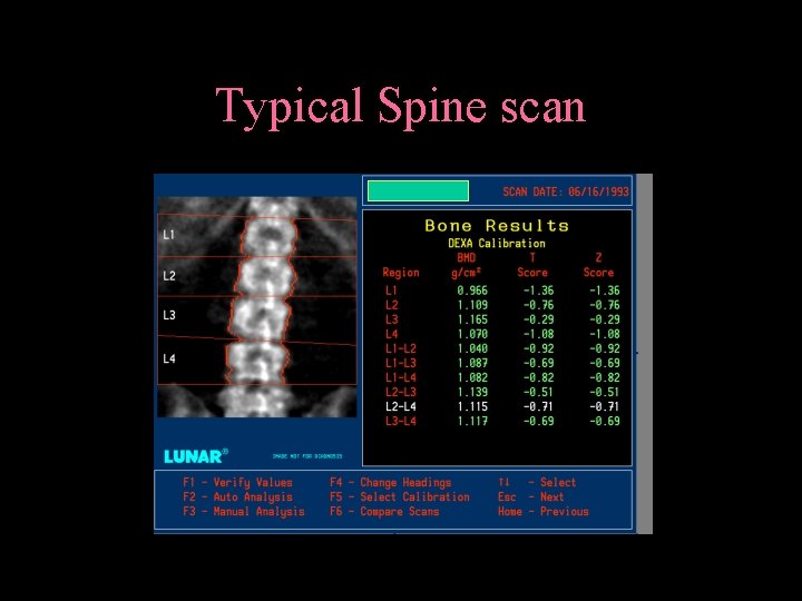 Typical Spine scan 