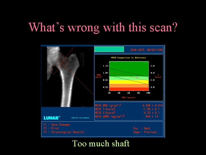 What’s wrong with this scan? Too much shaft 