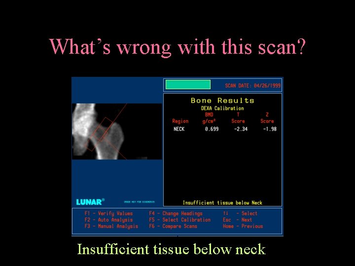 What’s wrong with this scan? Insufficient tissue below neck 