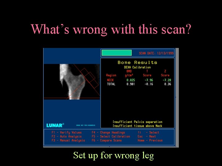 What’s wrong with this scan? Set up for wrong leg 