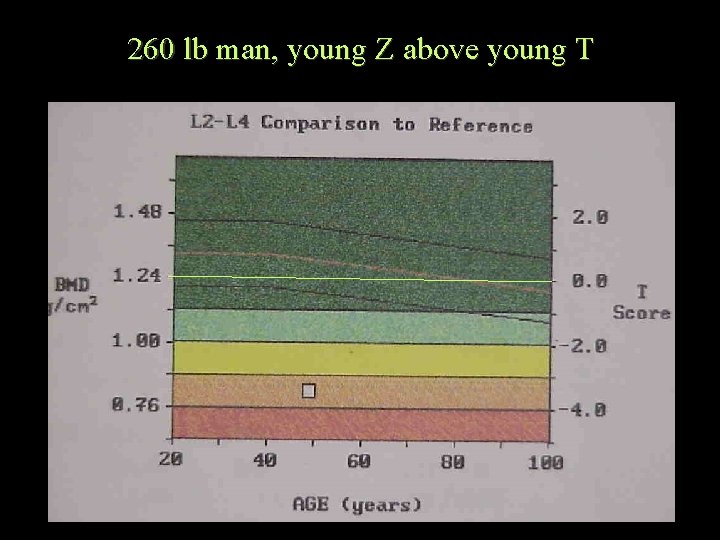 260 lb man, young Z above young T 