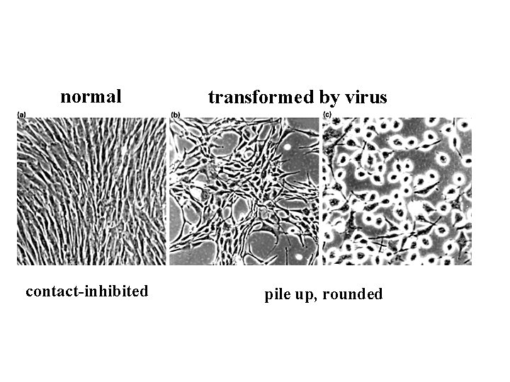 normal contact-inhibited transformed by virus pile up, rounded 
