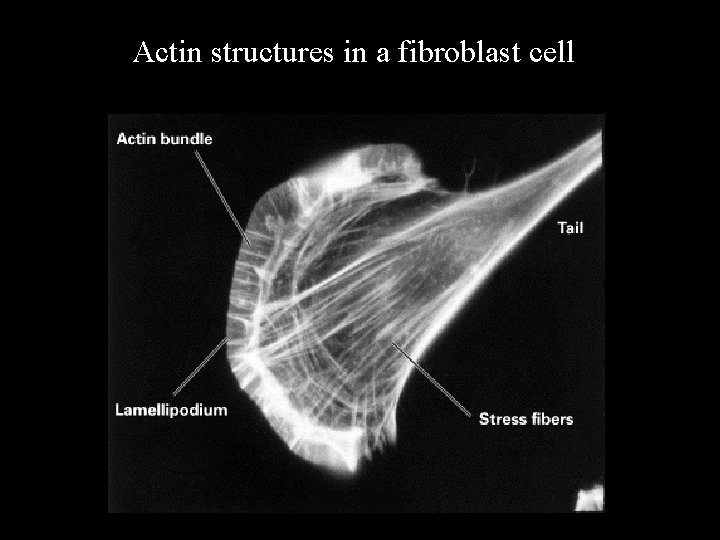 Actin structures in a fibroblast cell 