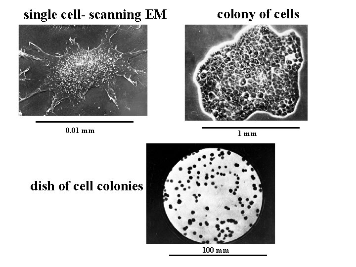 single cell- scanning EM colony of cells 0. 01 mm dish of cell colonies