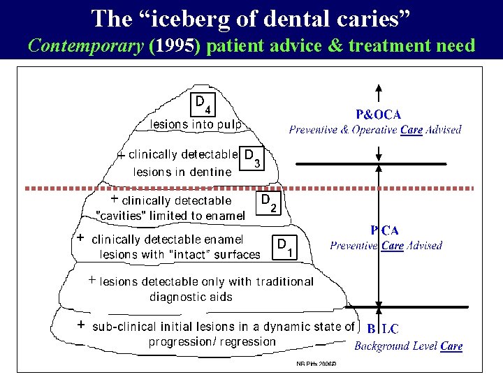 The “iceberg of dental caries” Contemporary (1995) patient advice & treatment need 