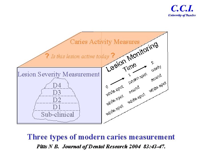 Caries Activity Measures ? Is this lesion active today ? Lesion Severity Measurement D