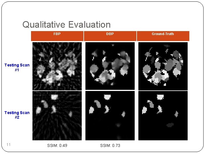 Qualitative Evaluation FBP DBP SSIM: 0. 49 SSIM: 0. 73 Testing Scan #1 Testing