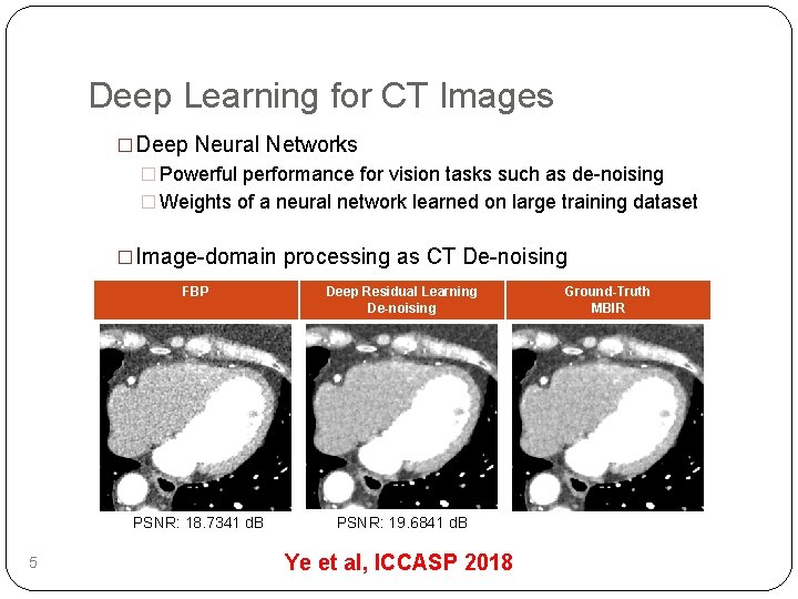 Deep Learning for CT Images �Deep Neural Networks � Powerful performance for vision tasks