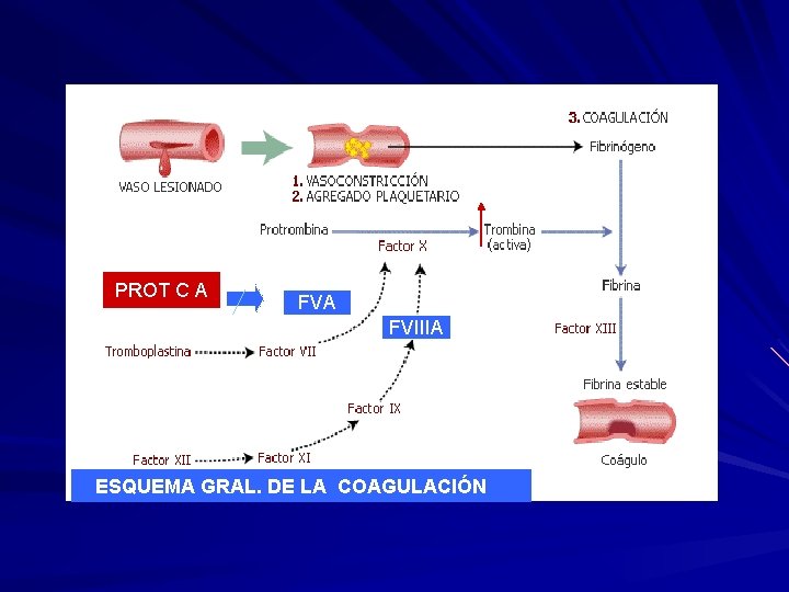PROT C A FVIIIA ESQUEMA GRAL. DE LA COAGULACIÓN 
