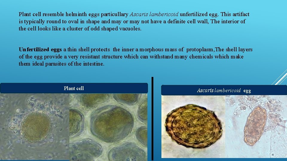 Plant cell resemble helminth eggs particullary Ascaris lambericoid unfertilized egg. This artifact is typically