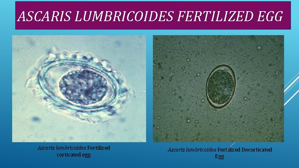 ASCARIS LUMBRICOIDES FERTILIZED EGG Ascaris lumbricoides Fertilized corticated egg. Ascaris lumbricoides Fertilized Decorticated Egg